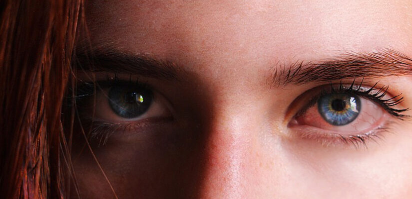 Por que os olhos ficam vermelhos depois de usar maconha?